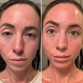 files/Before_Afters_9.webp