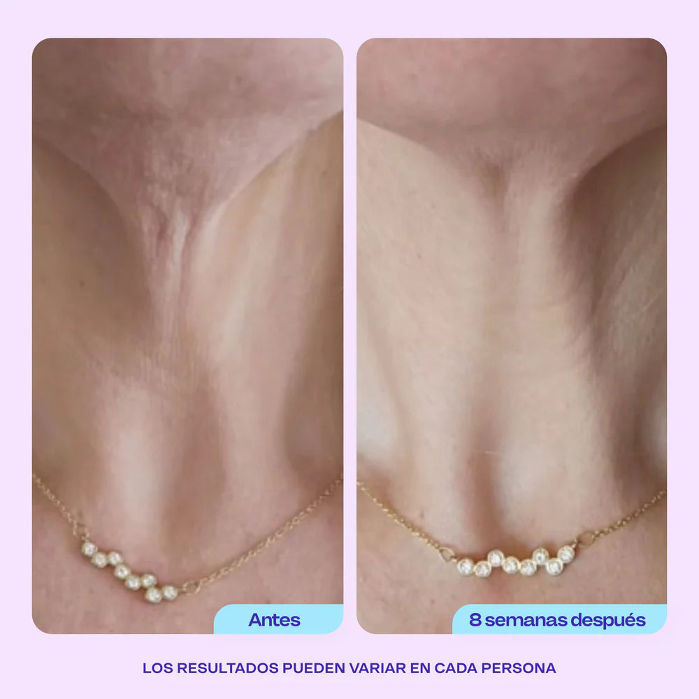 Crema Gopure - Reafirma tu cuello Hoy Mismo!