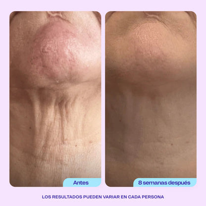 Crema Gopure - Reafirma tu cuello Hoy Mismo!